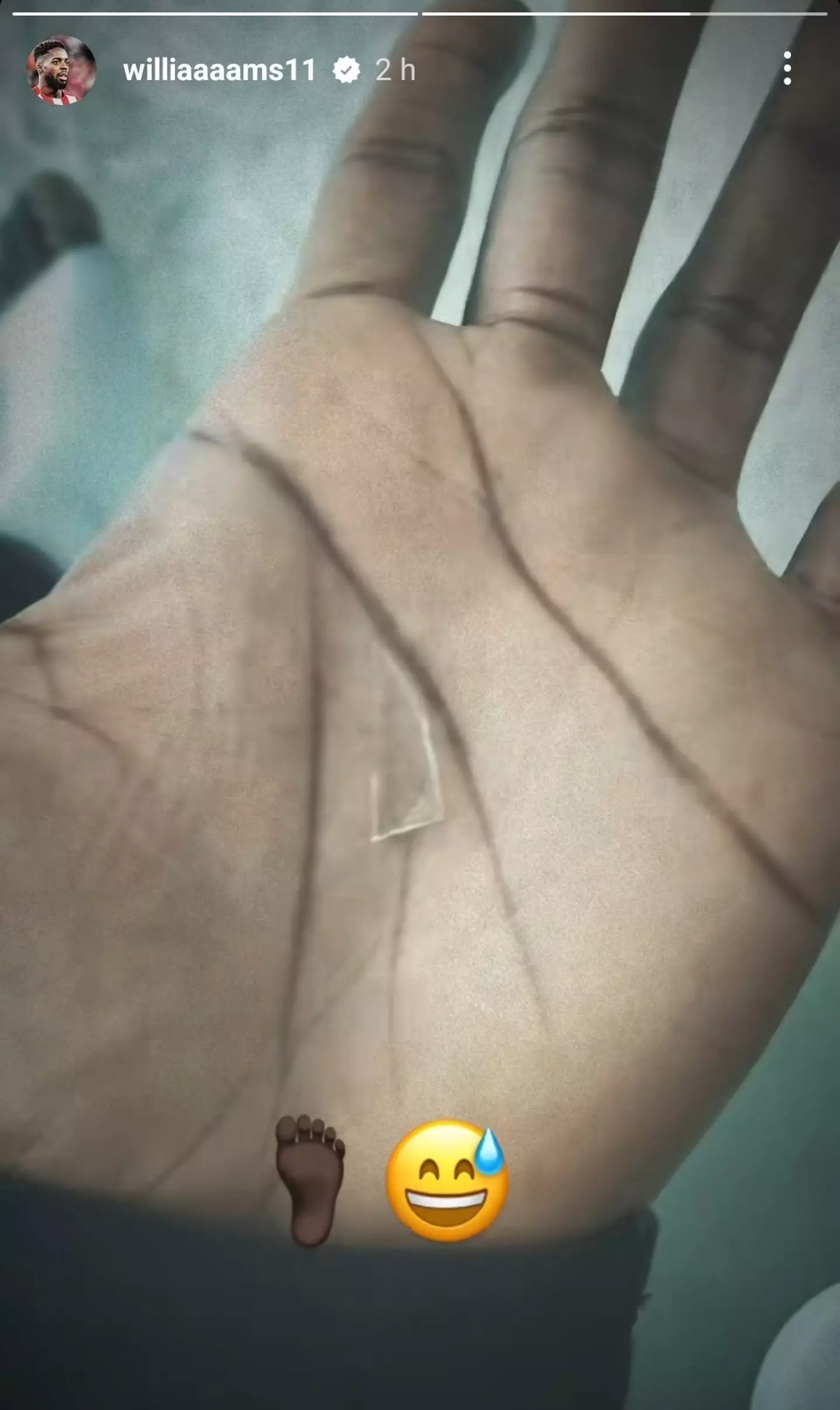 Williams shared a picture of the glass on his Instagram after having surgery. Image credit: @williaaaams11