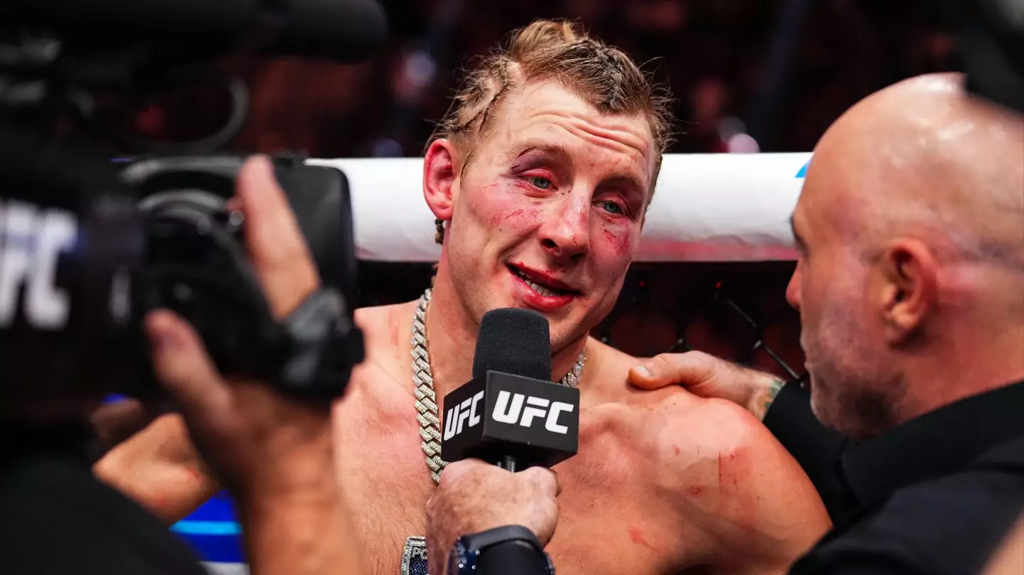 Paddy Pimblett Looks Unrecognisable as His Wife Shares Horrific Image of His Face