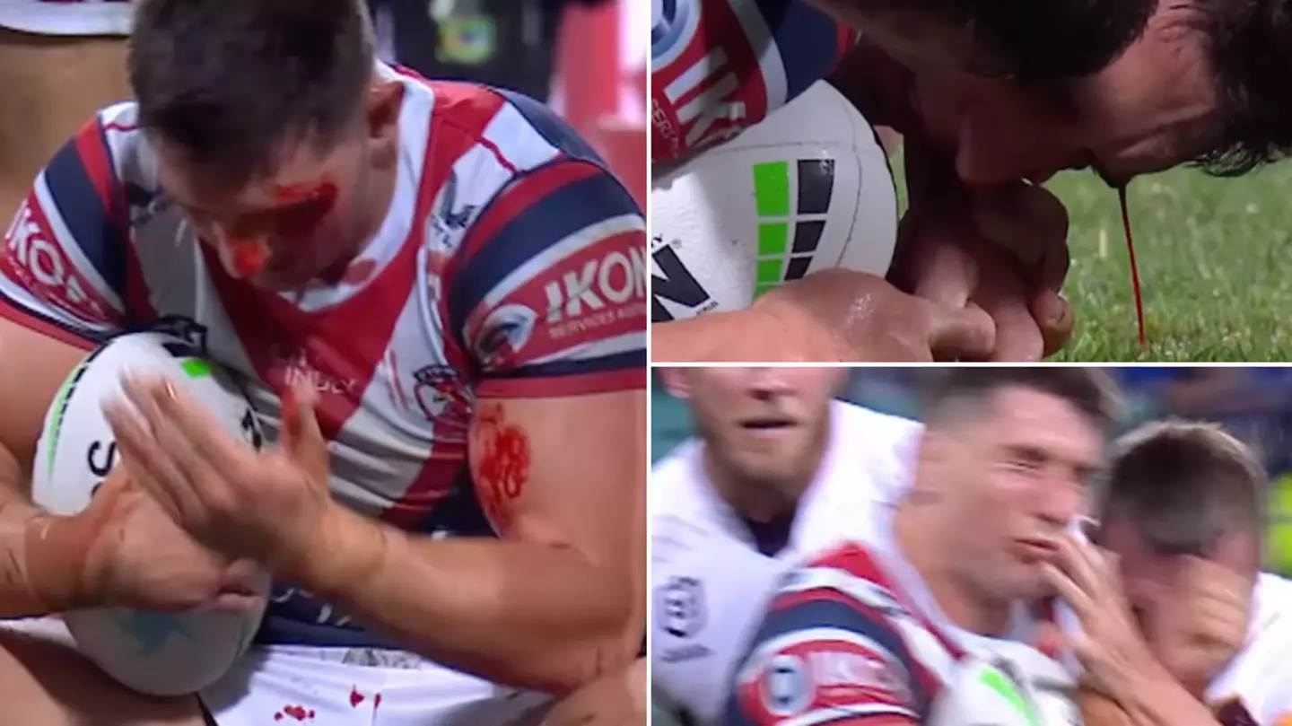 Nasty collision sees blood pour and squirt from Victor Radley's head