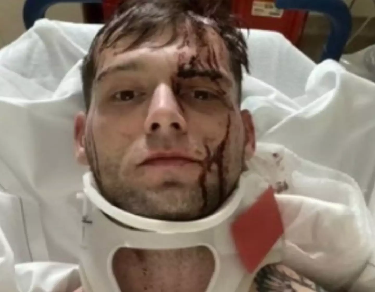 He was treated in hospital is now said to be 'resting and healing' (Image: MyMMANews)