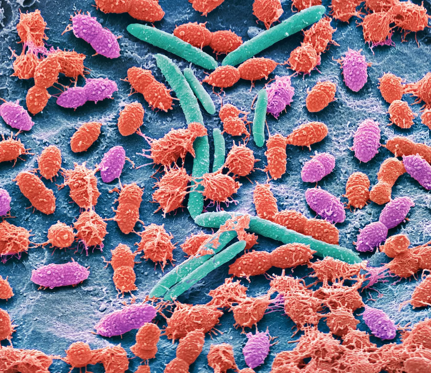 The bacteria poses a threat to humanity (STEVE GSCHMEISSNER/SCIENCE PHOTO LIBRARY/Getty Images)