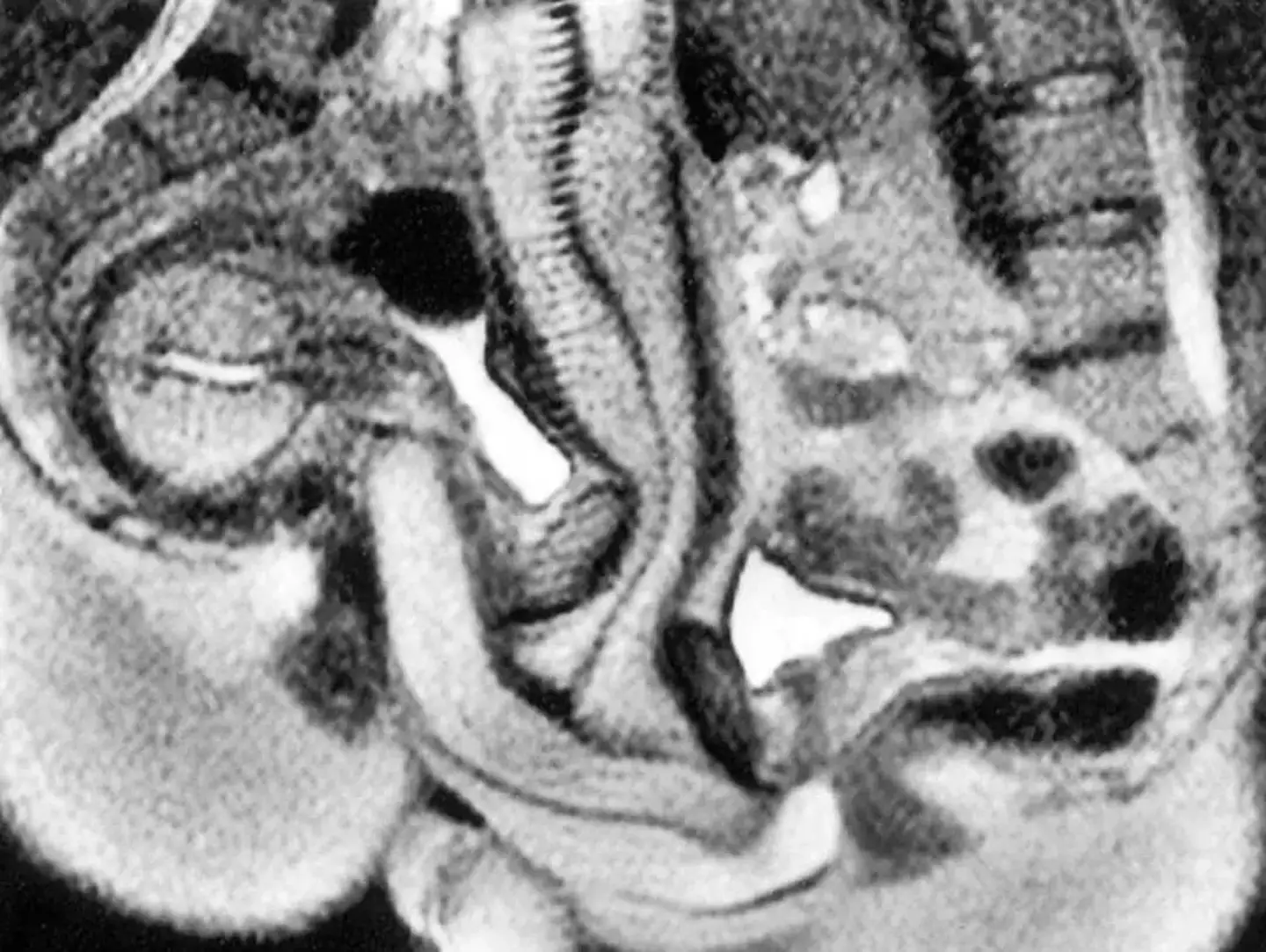 The images have become the stuff of legend (British Medical Journal)