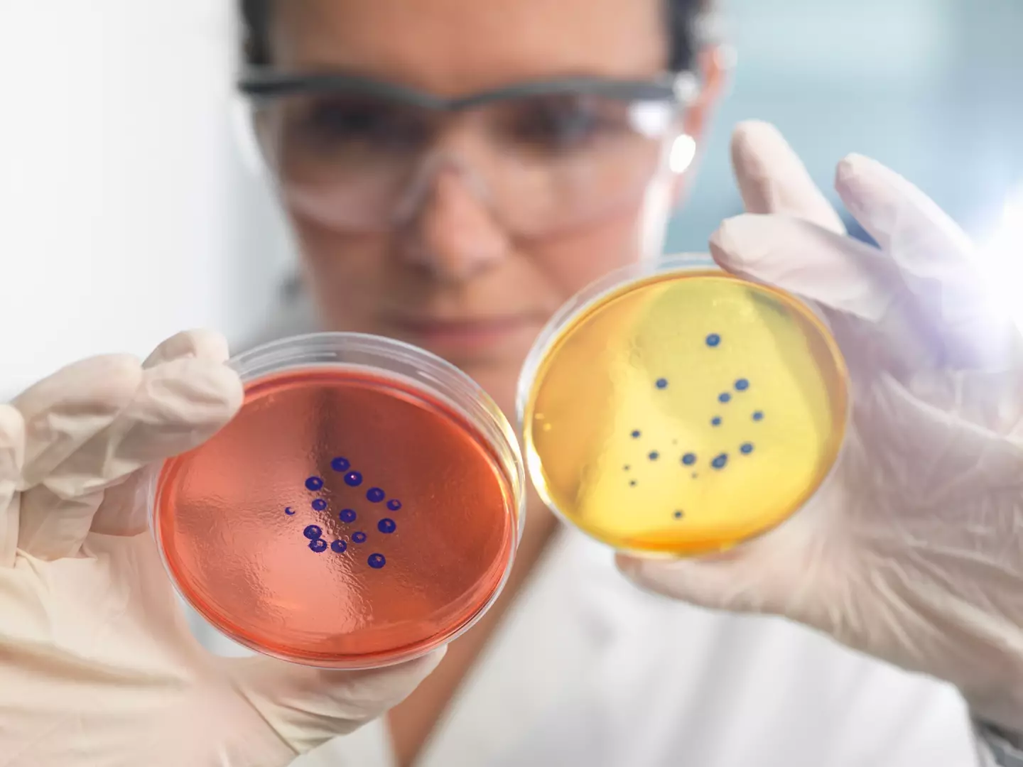 Scientists are warning the public about a mysterious bacteria (Rafe Swan/Getty Images)