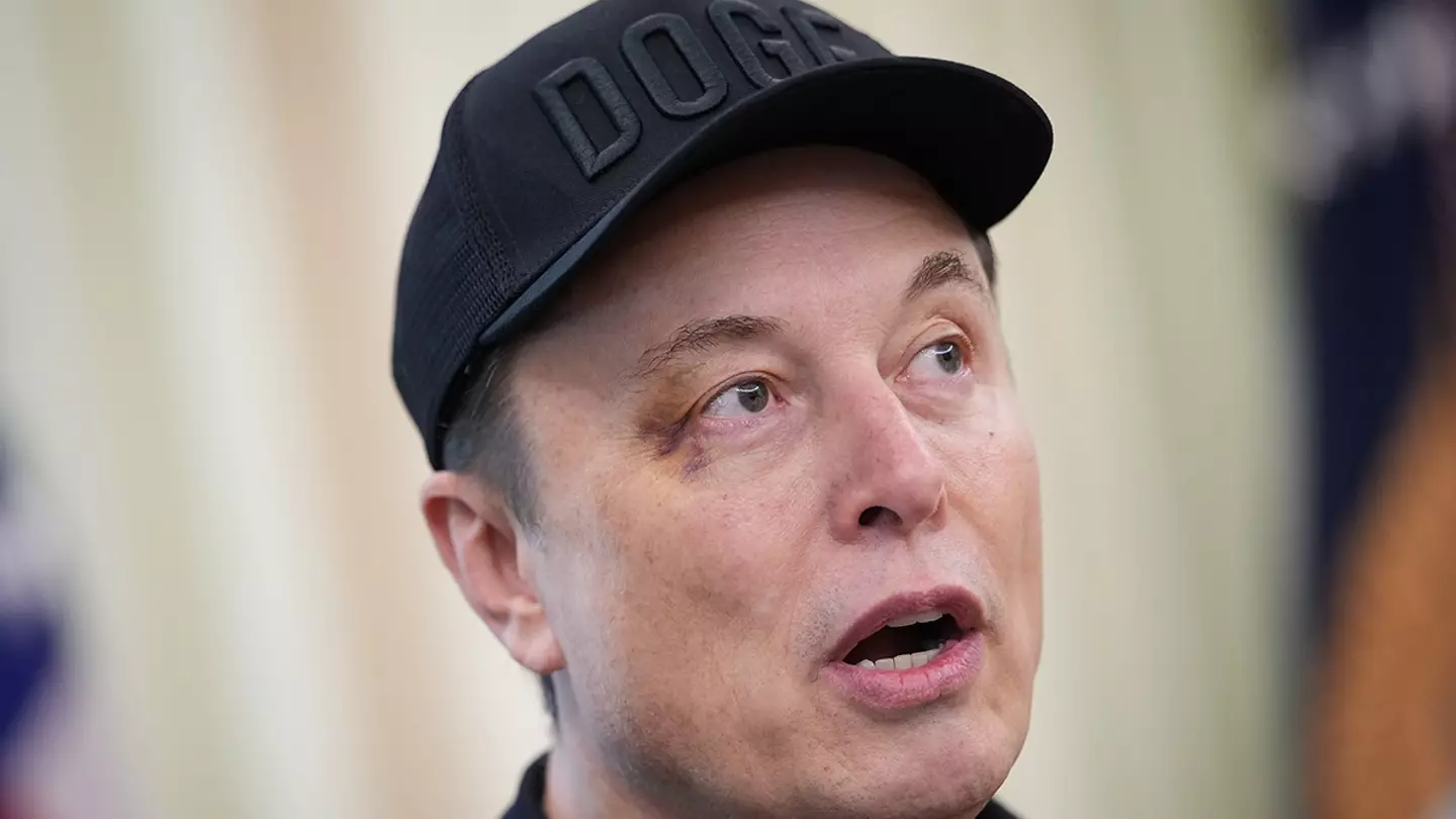 Elon Musk with a black eye (Kevin Dietsch/Getty Images)