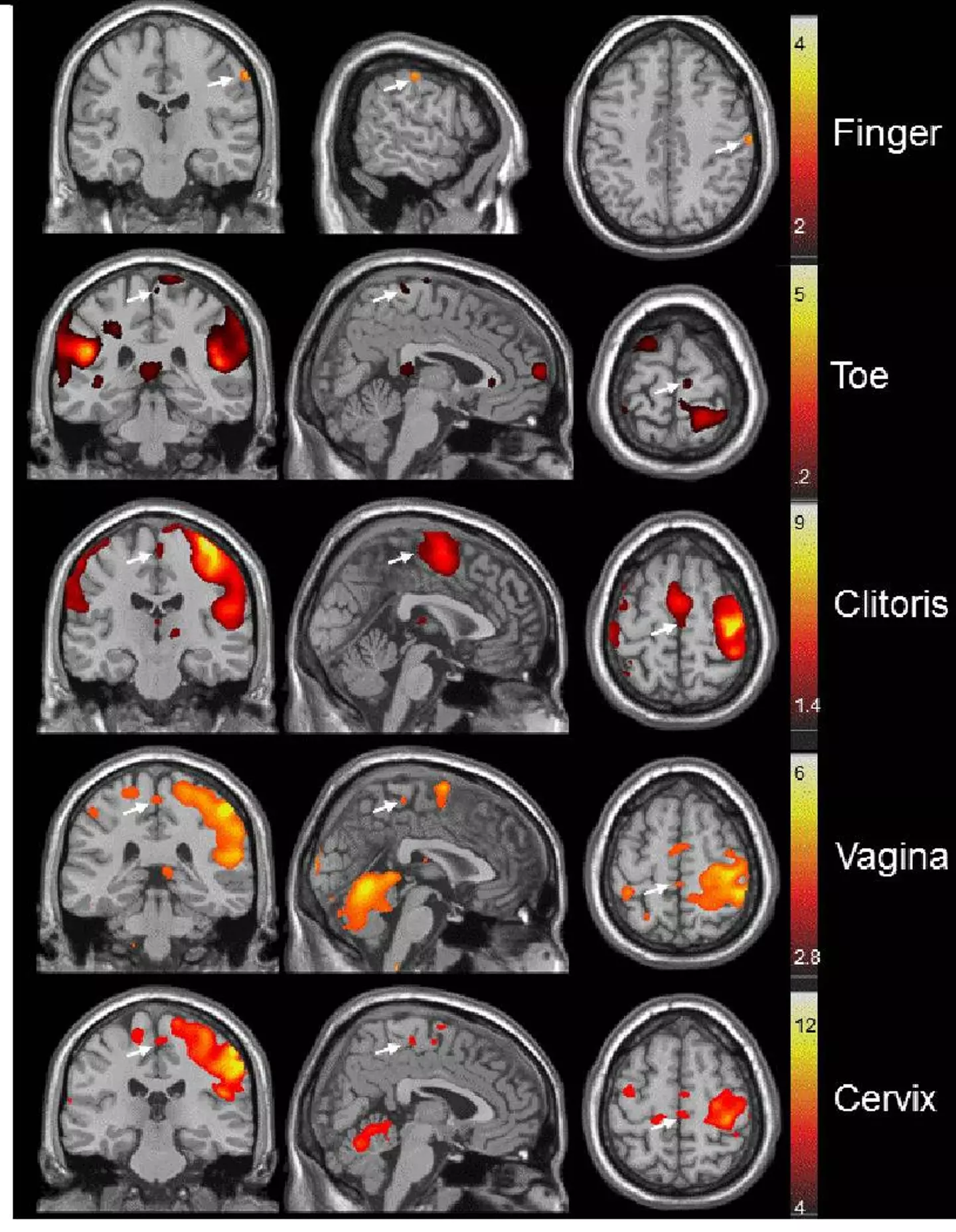 Komisaruk mapped the female orgasm to climax (Komisaruk et al 2011)