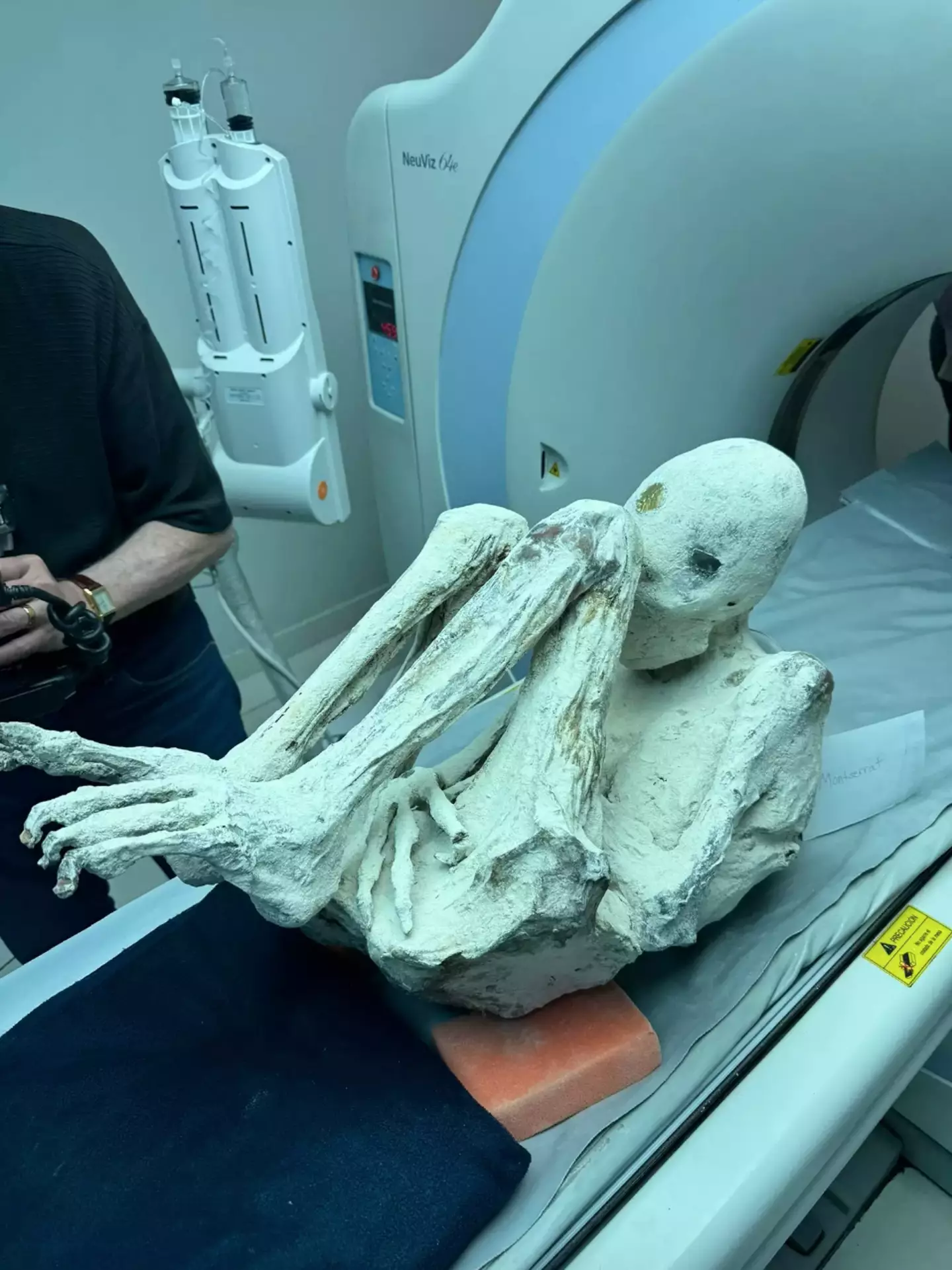 Peru has seen a spike in grave-robbing at the site where a three-fingered 'alien mummy' was found (X/@pikespeaklaw)