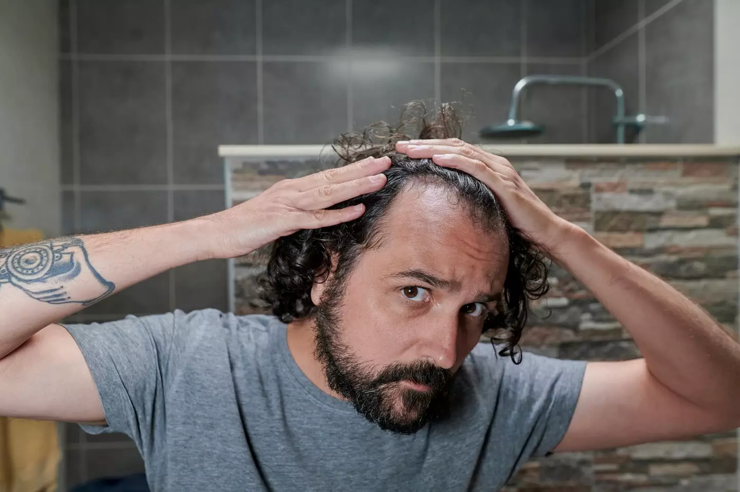 Pattern baldness and receding hair lines is something that affects up to 80% of men worldwide (Getty Stock)