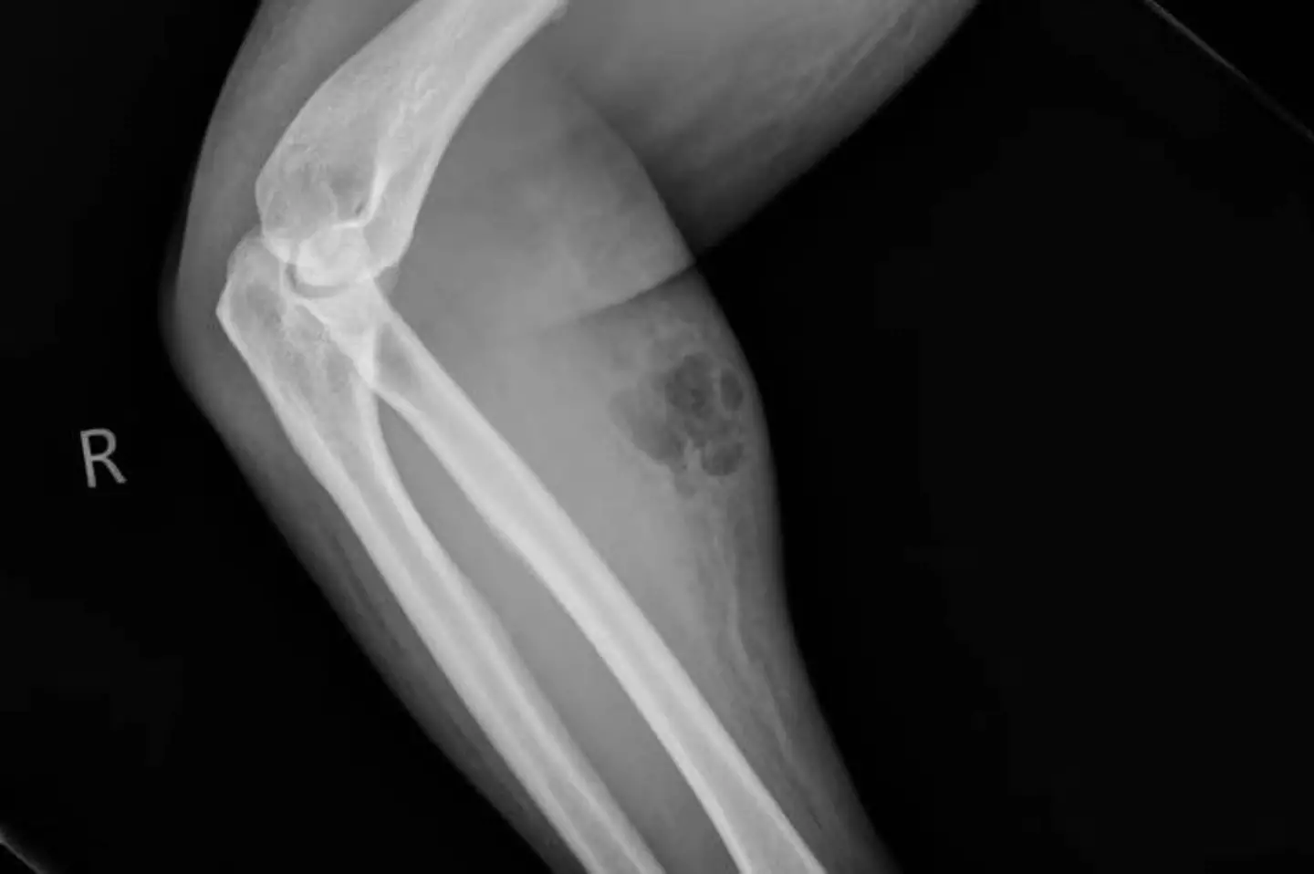 Doctors claim it's the only known case they've come across (Irish Medical Journal)