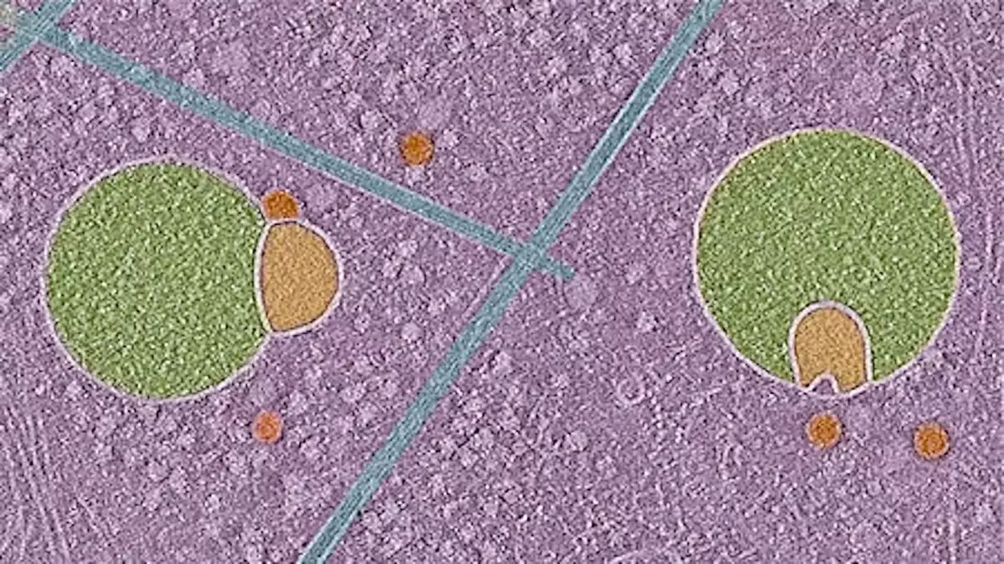 Hemifusomes could help us understand how Alzheimer's manifests (UVA Health)