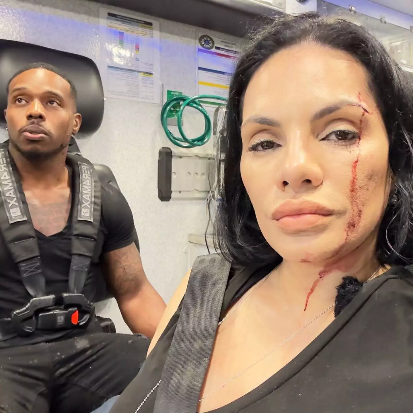 Santiago shared photos of her injuries online (Instagram / @ninaunrated)