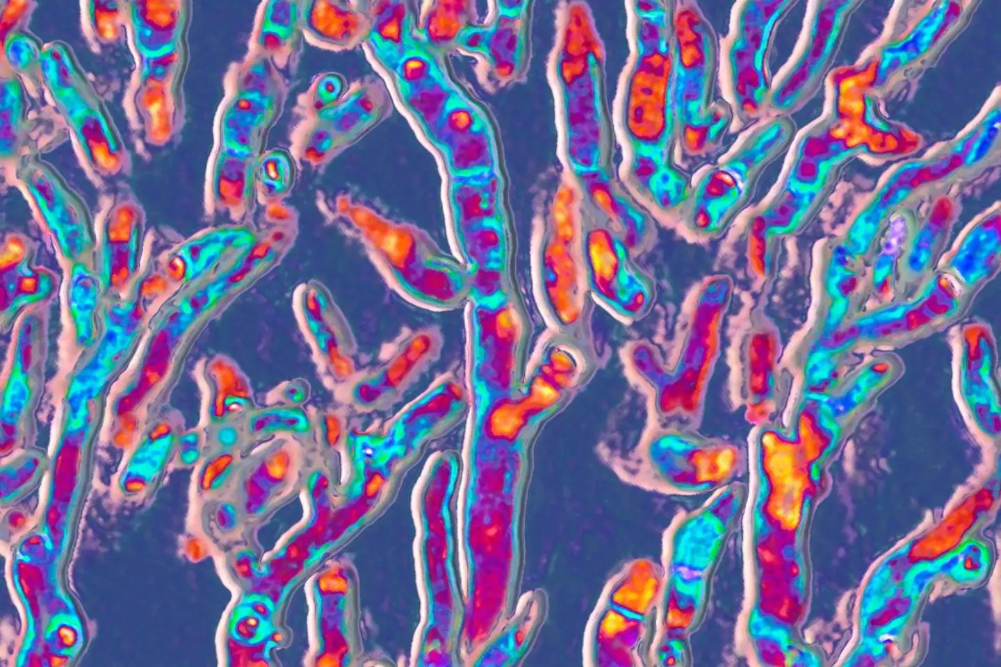 Aspergillus fumigatus can be deadly (BSIP / Contributor / Getty)