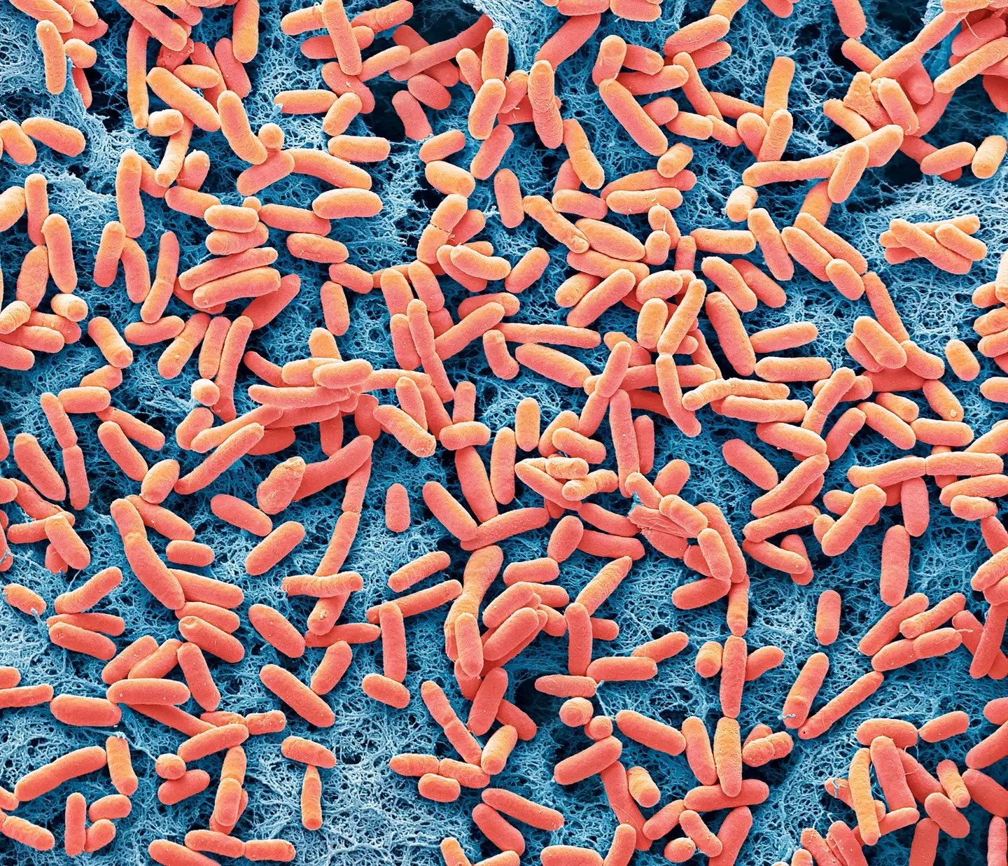 Syn57 is a bioengineered version of E. coli bacteria. (STEVE GSCHMEISSNER/SCIENCE PHOTO LIBRARY/Getty)