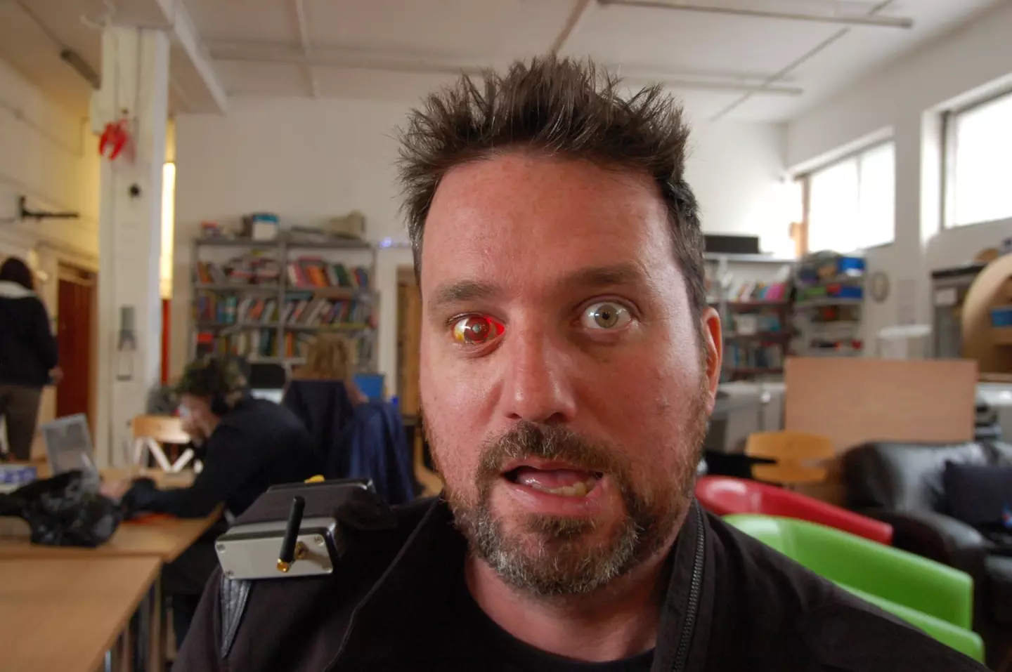 The man has been dubbed as "Eyeborg" (Rob Spence)
