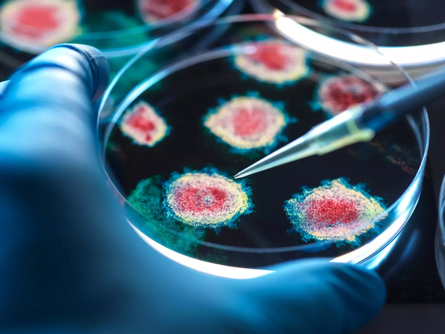 The new virus was discovered by scientists (TEK IMAGE/SCIENCE PHOTO LIBRARY/Getty Images)