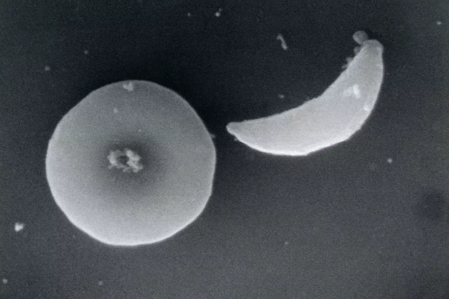 New research could help identify T. gondii and minimize the effects it has on your brain (BSIP/UIG Via Getty Images)