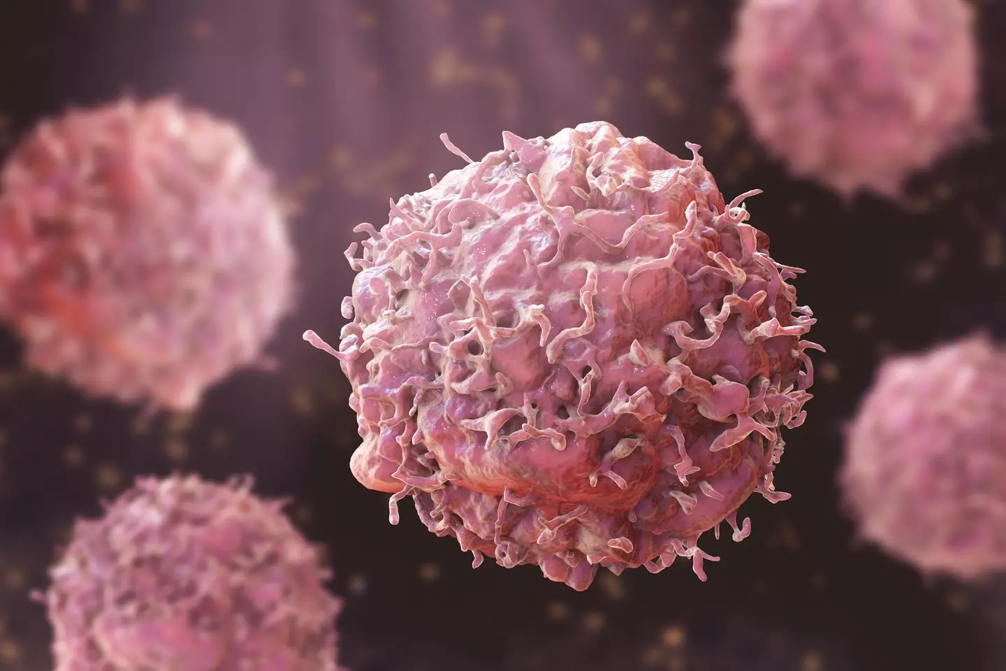 Scientists have discovered an 'unexpected' way to prevent cancer cells from spreading around the body (Getty Stock)