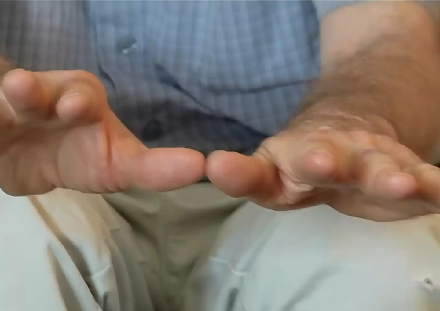 His hands became completely still after taking the medical cannabis, showing the extreme and mind blowing transformation (YouTube/ScienceExplainedOfficial)
