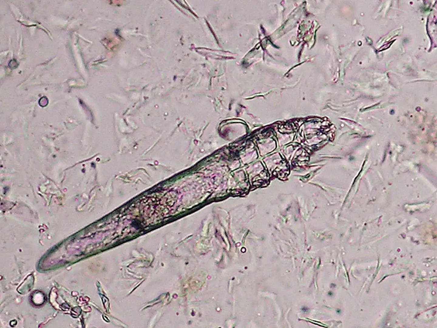 For such tiny creatures, Demodex mites can cause big problems (Agency-Animal-Picture / Contributor / Getty)