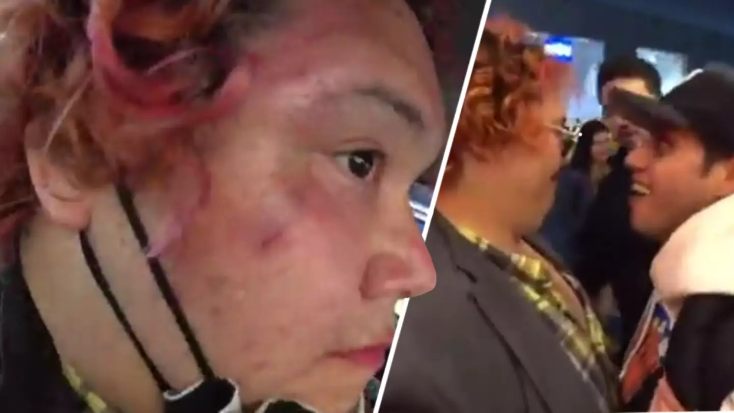 Twitch Streamer Physically Assaulted By Strangers Mid-Broadcast