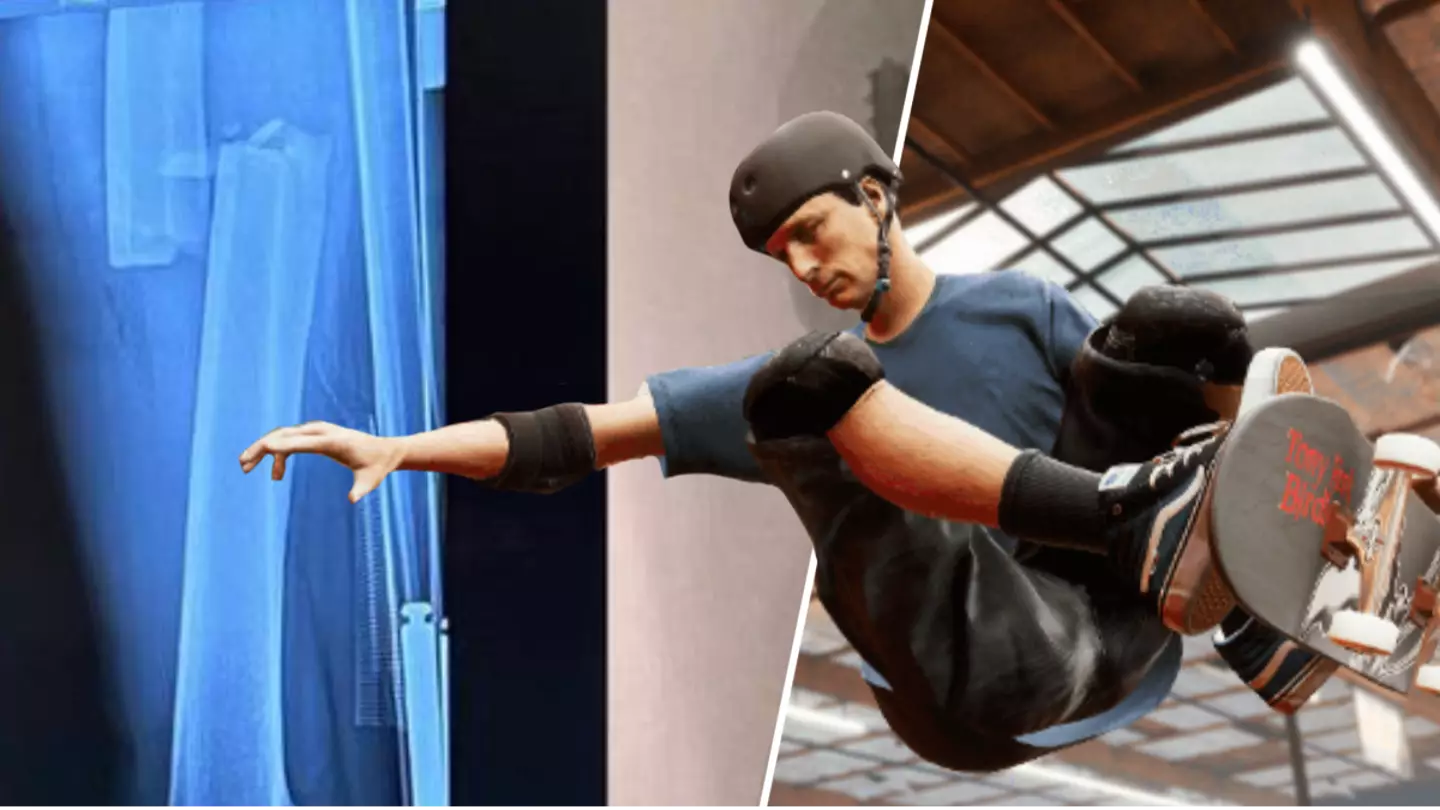 Tony Hawk Is Boarding Again, Just Two Weeks After Serious Accident