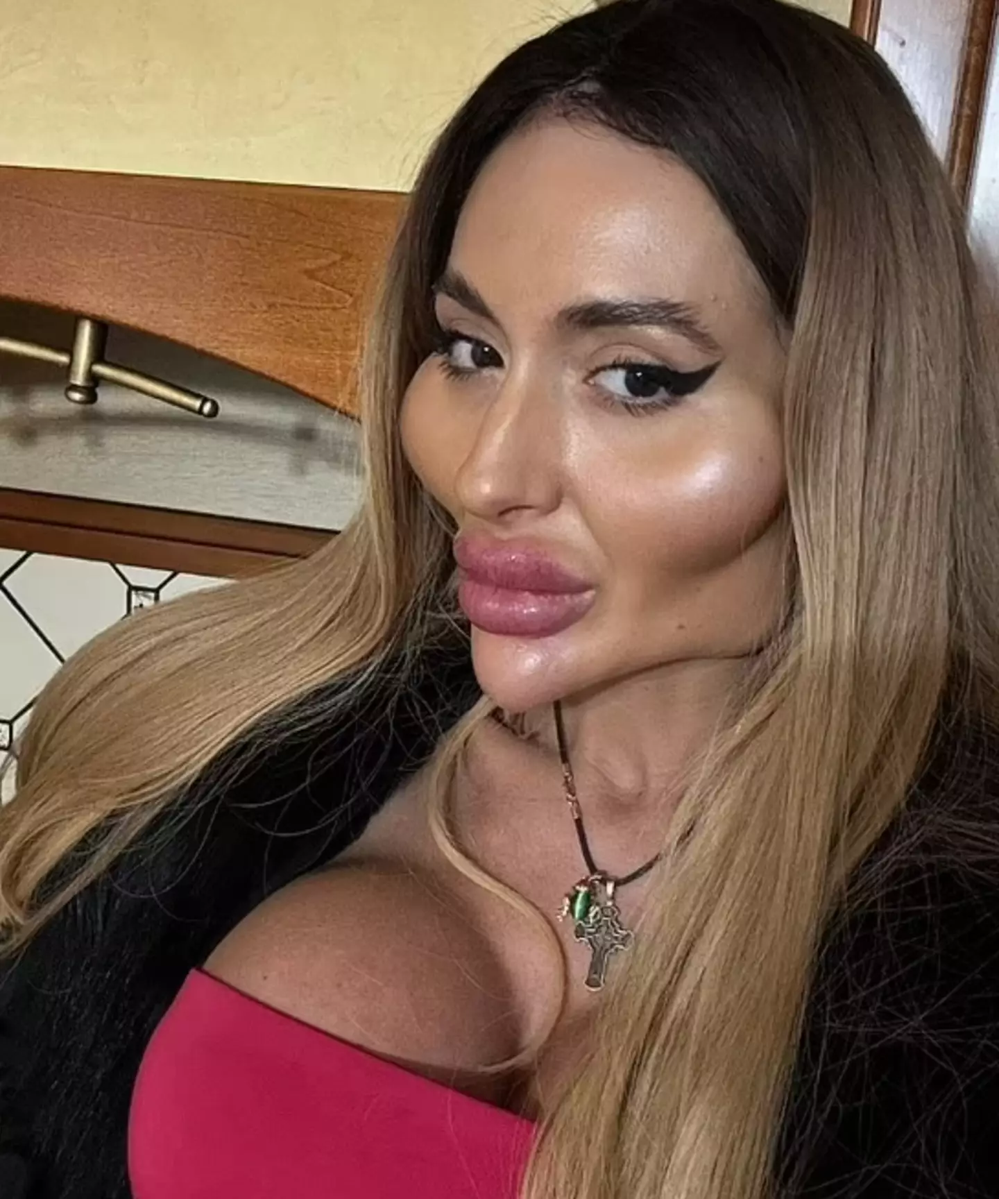 The model has said she 'feels pretty' with her filler.