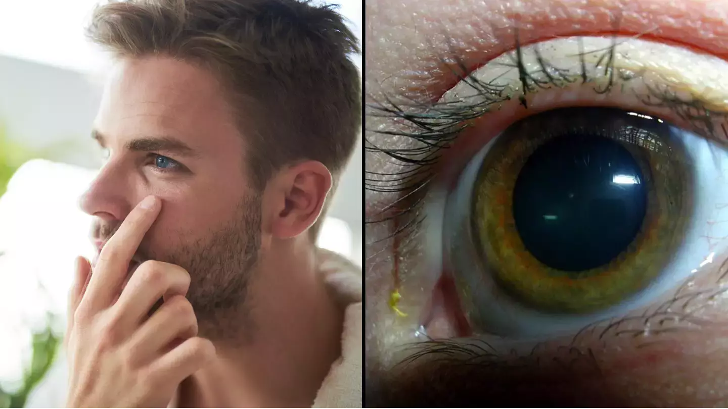 People shocked after discovering what 'yellow sleep' in your eye when you wake up actually is