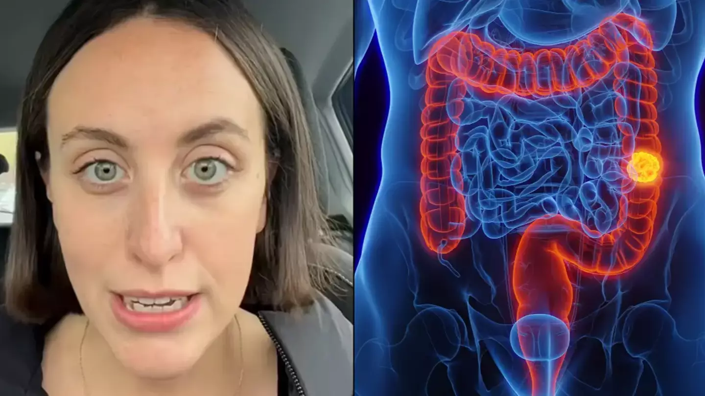 Woman diagnosed with bowel cancer aged 25 reveals unusual symptom all young people should know