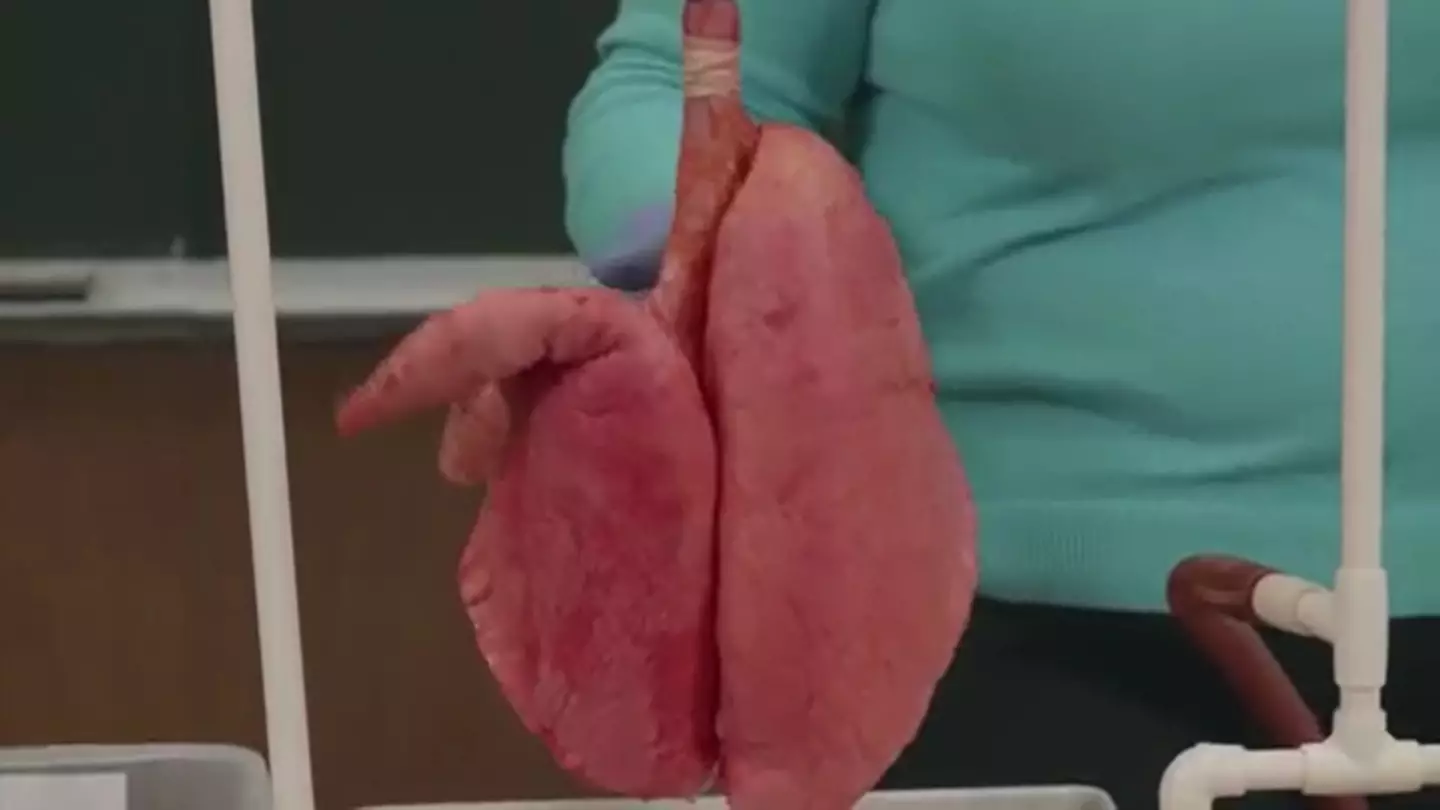 If these were still attached to a person they'd be a perfectly healthy set of lungs.