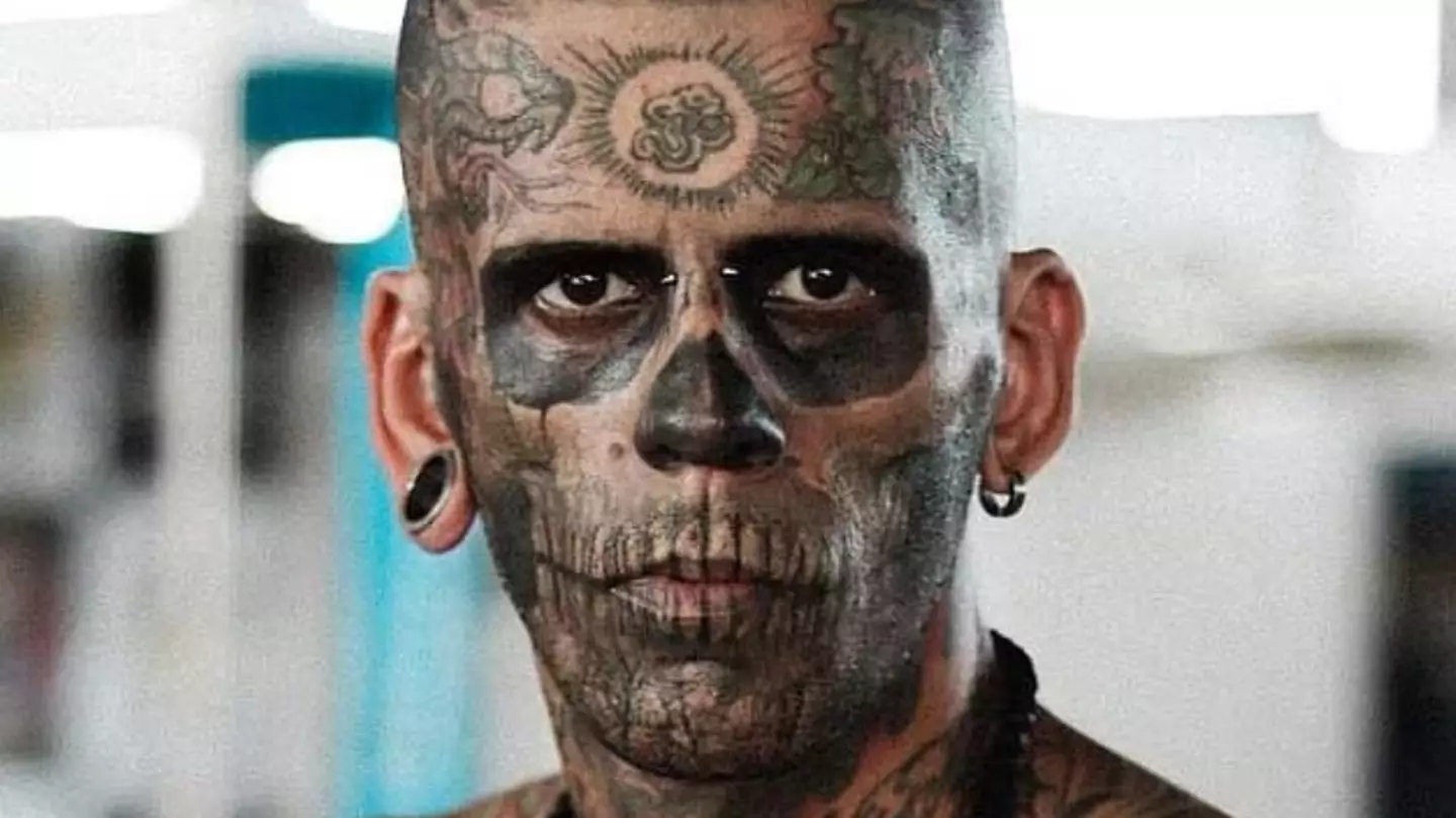 Man who had tattooed 95% of his body reveals what he looks like after having them removed