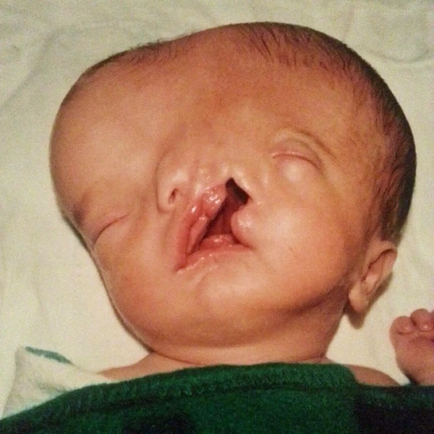 Tres has had various procedures to improve his condition.