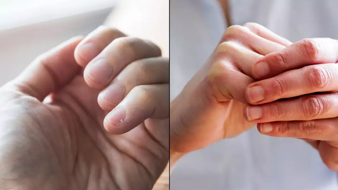 Simple finger test you can do at home to see if you're suffering from serious health problem