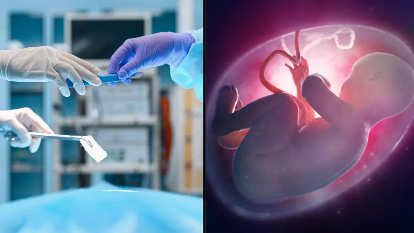 Surgeon Will Attempt To Transplant A Womb Into A Trans Woman To Help Them Get Pregnant