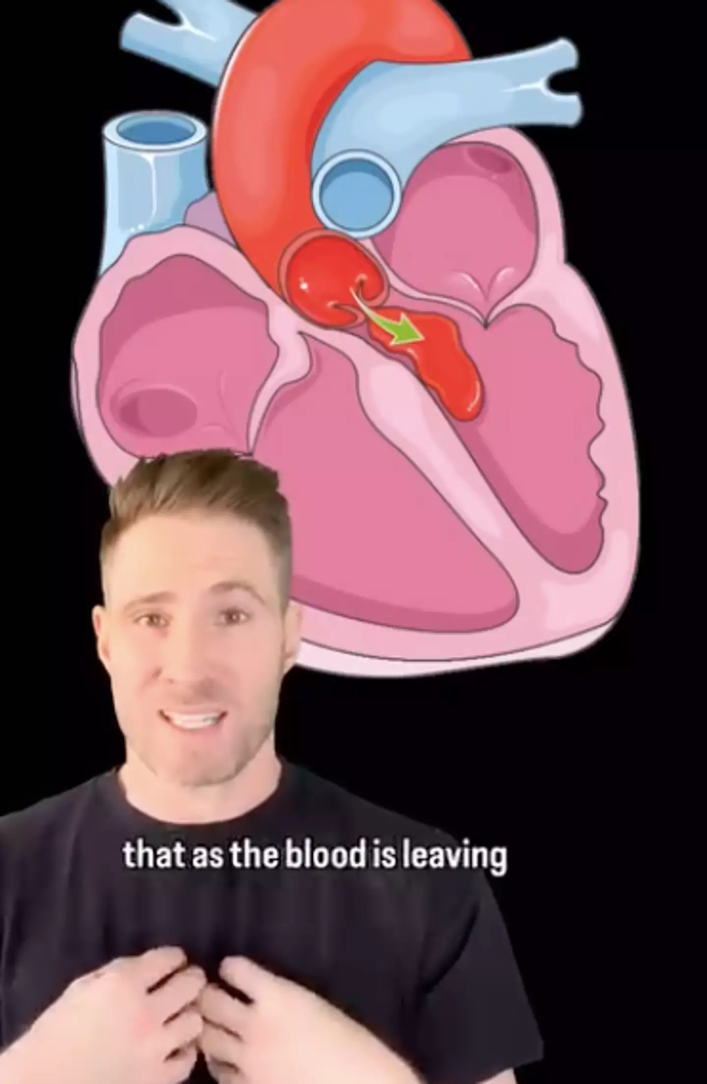 Aortic regurgitation is a condition where blood flows back into the heart instead of moving forward. (Instagram/@drjoe_md)