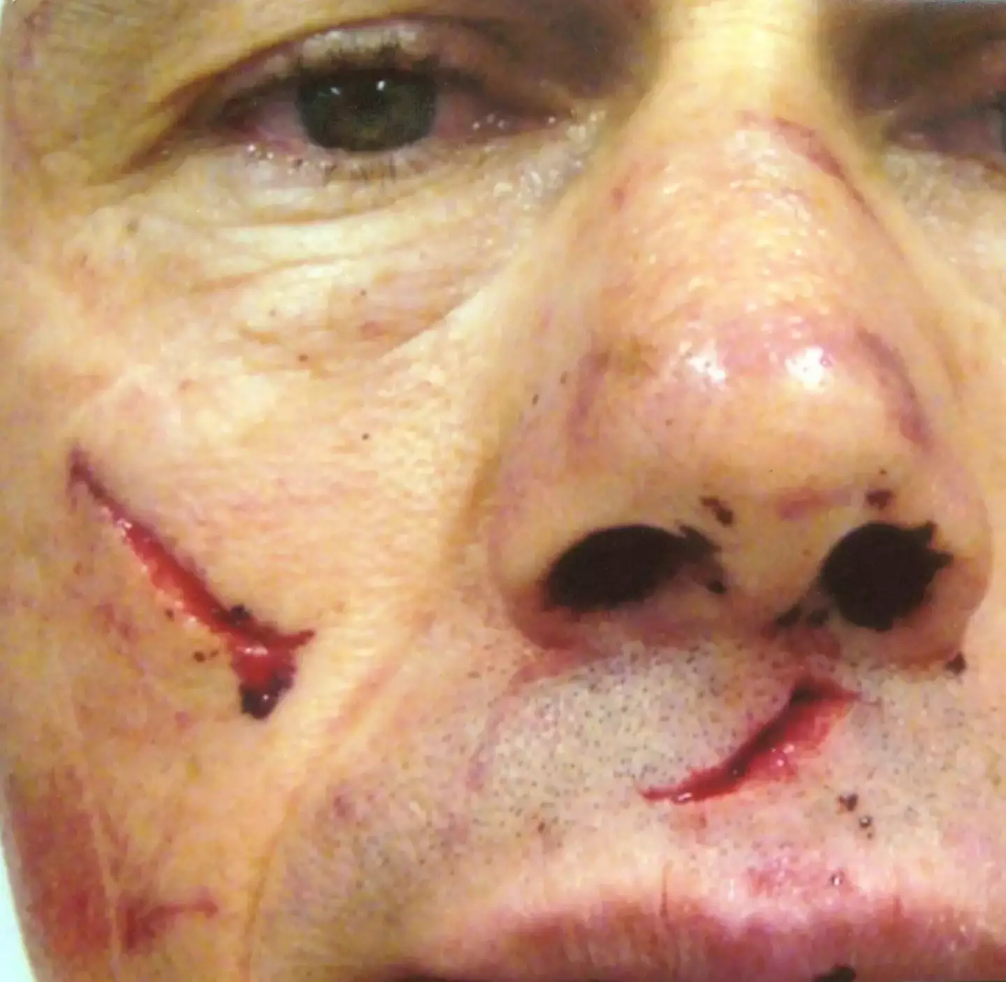 The injuries Eric sustained from the brutal attack. (Facebook/Eric Nerhus)