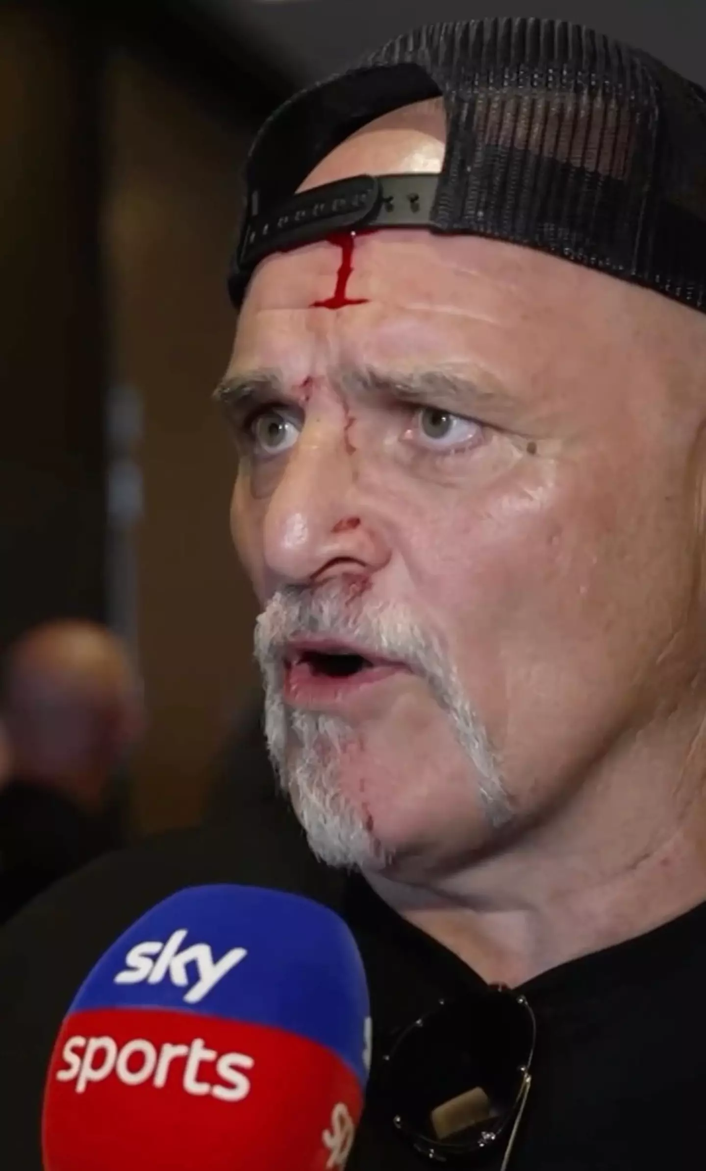 John Fury explained his side of things while still sporting a bloody forehead (Sky Sports)