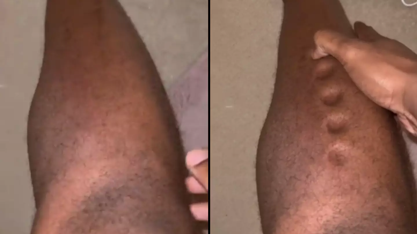 Olympian horrifies fans with alarming video after 'legs turn to playdough' due to silent killer