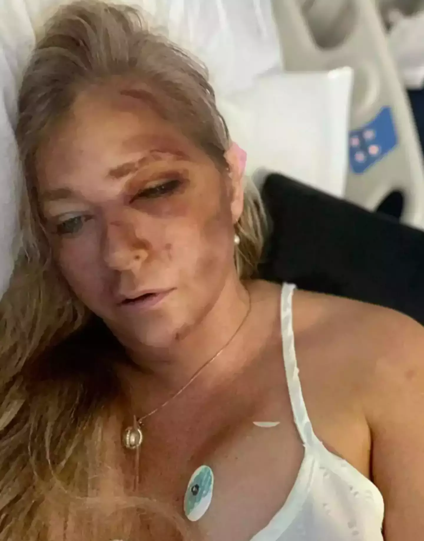 Virginia shared an image of herself appearing bruised alongside her post (Instagram/@virginiarobertsrising11)