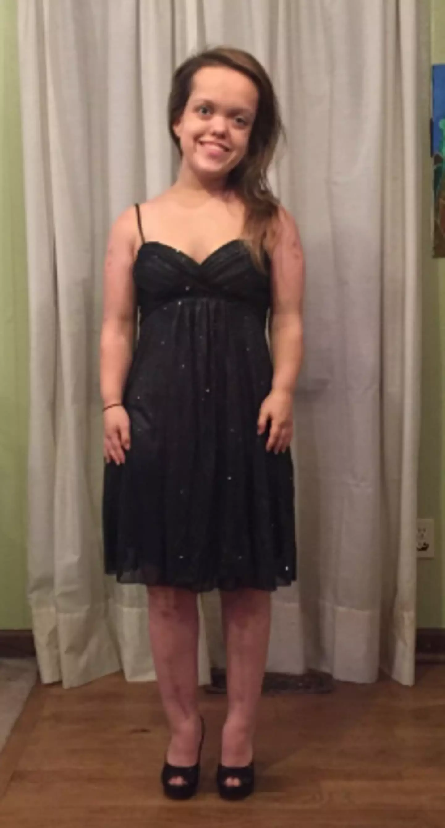 What Chandler looked like after surgery (chandlercrews.com)