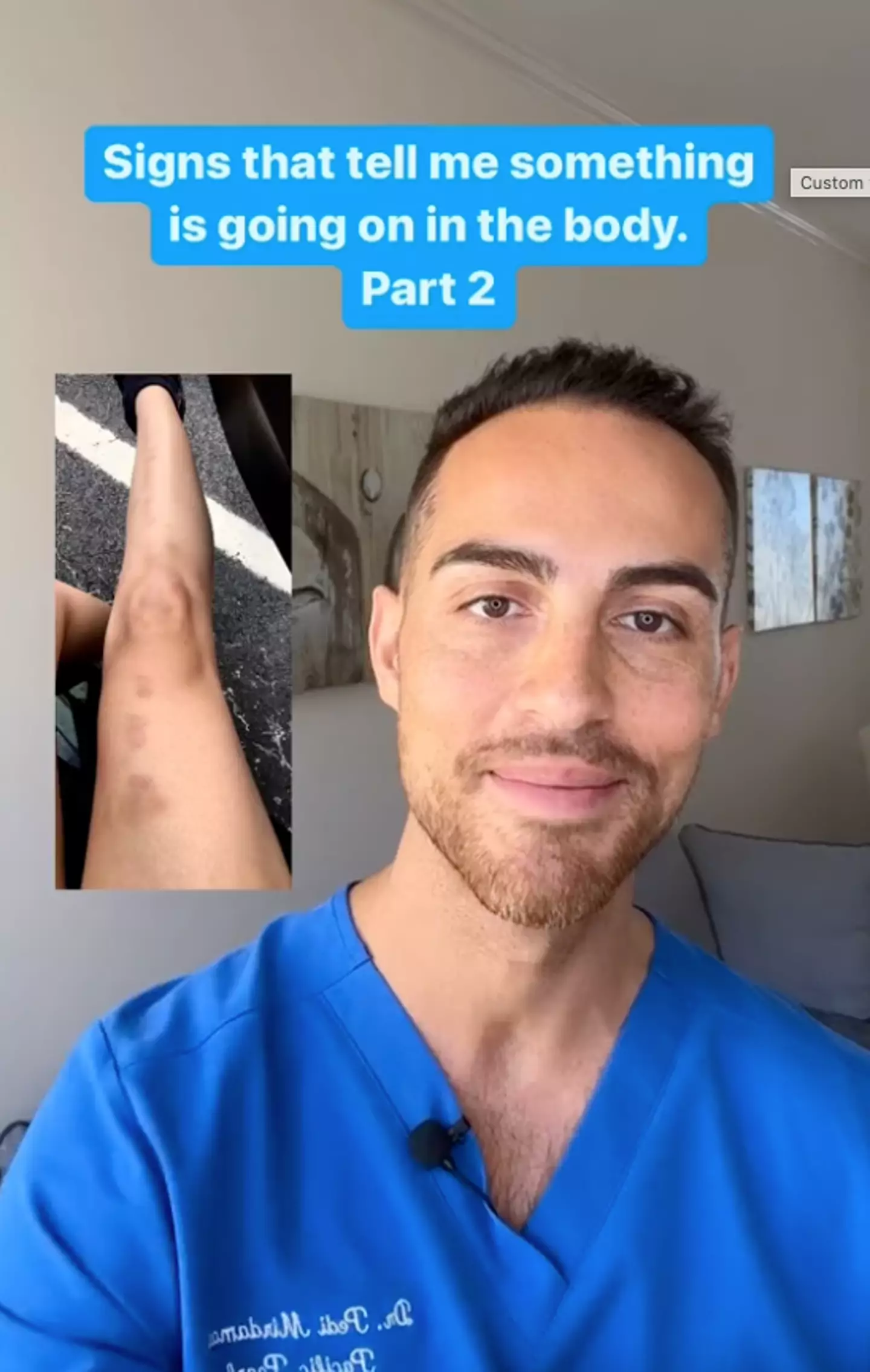 Licensed naturopathic doctor Pedi Mirdamadi has revealed why some people might get frequent bruising (TikTok/@drpedinaturalhealth)