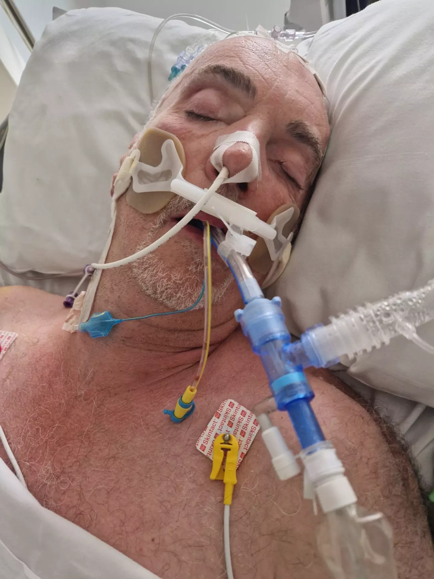 However the 67-year-old was left fighting for his life after developing Legionnaires (SWNS)