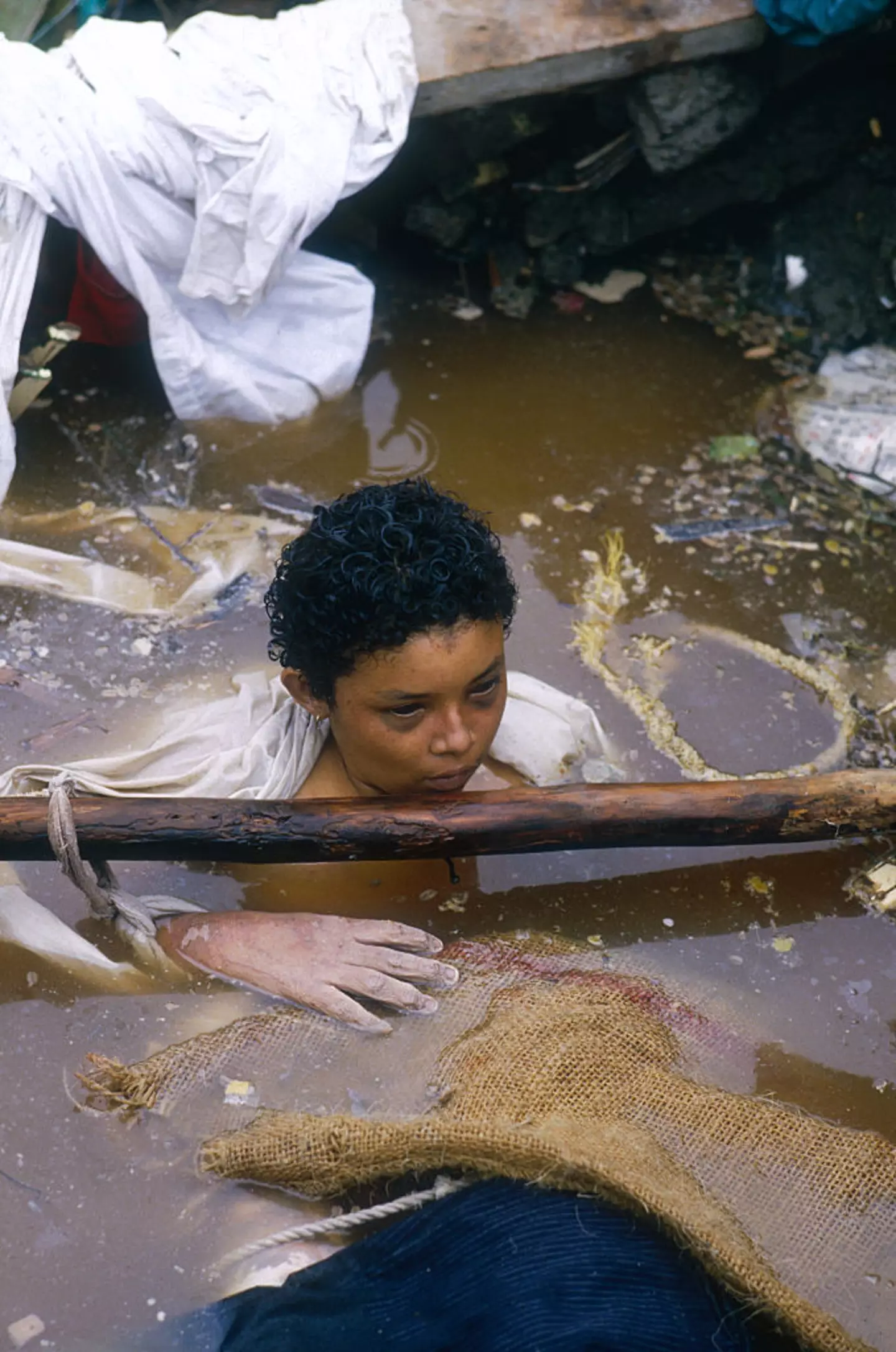 Omayra died from gangrene or hypothermia (Jacques Langevin/Sygma/Sygma via Getty Images)