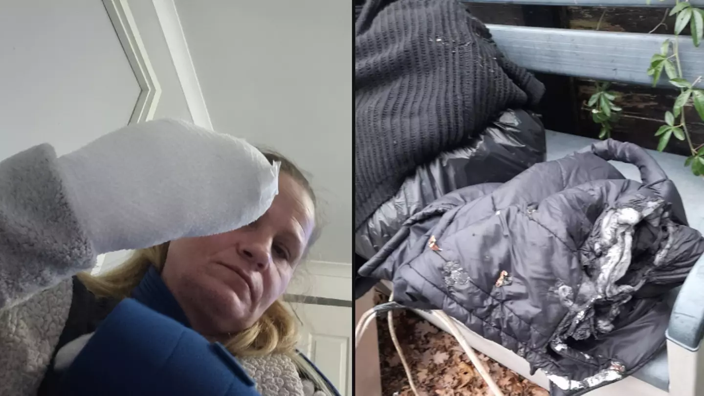 Woman issues urgent vape warning after she 'almost died' when puffer jacket set on fire
