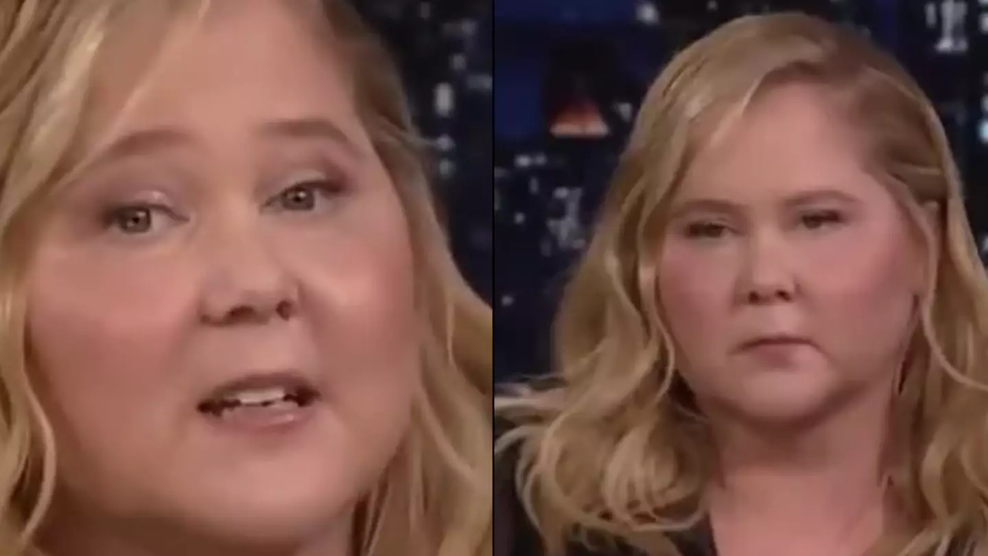 Amy Schumer responds to concern explaining her 'puffier' and swollen face