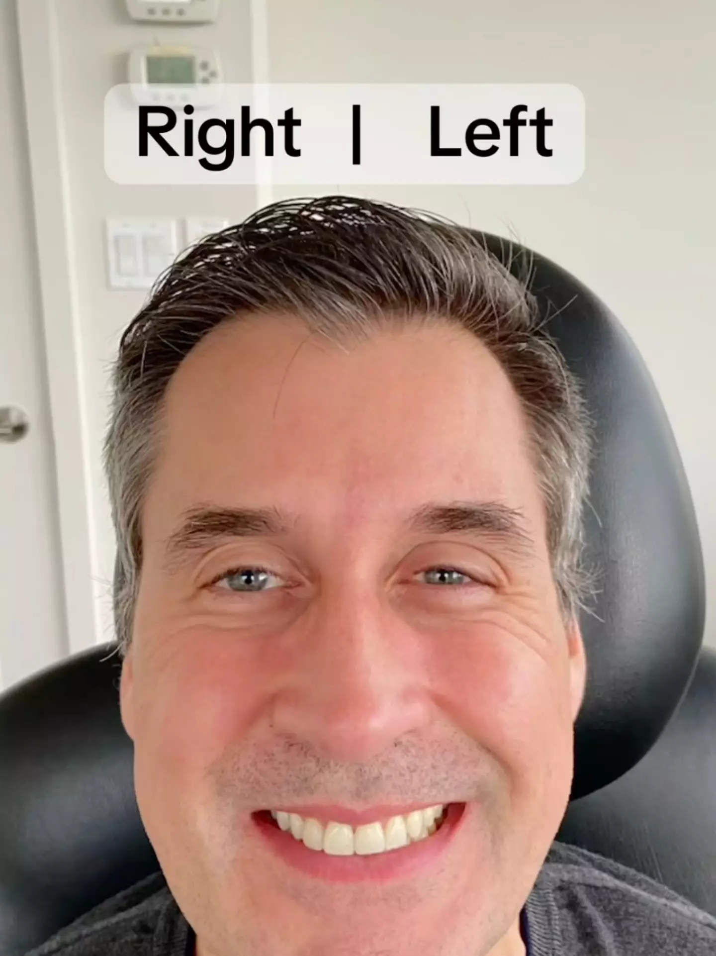 Dr Katie Beleznay injected the right side of her husband's face with Botox to demonstrate the impact it can have (YouTube/@drkatiebeleznay)