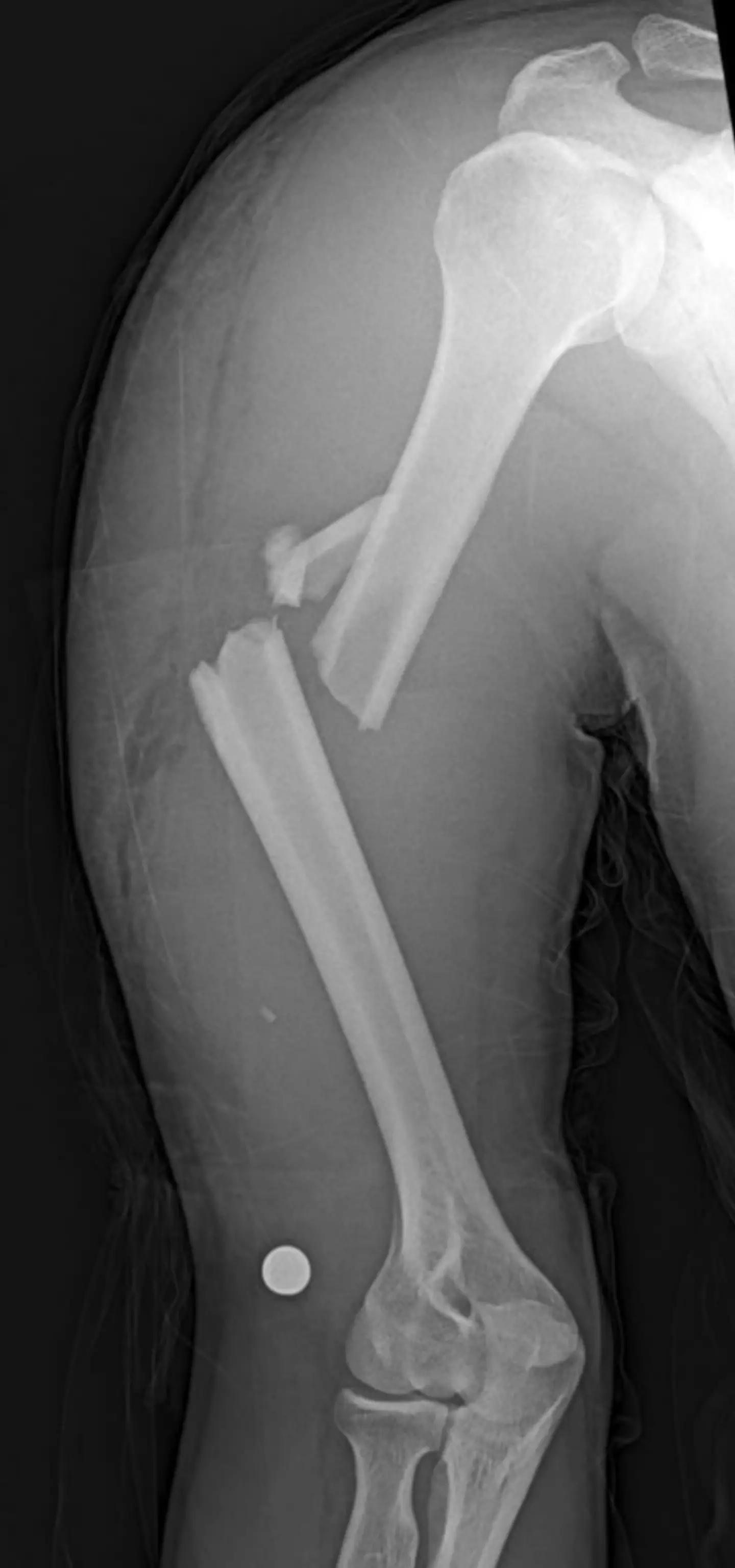 However your chances of breaking a bone are down to more than divine protection (Getty Stock Images)