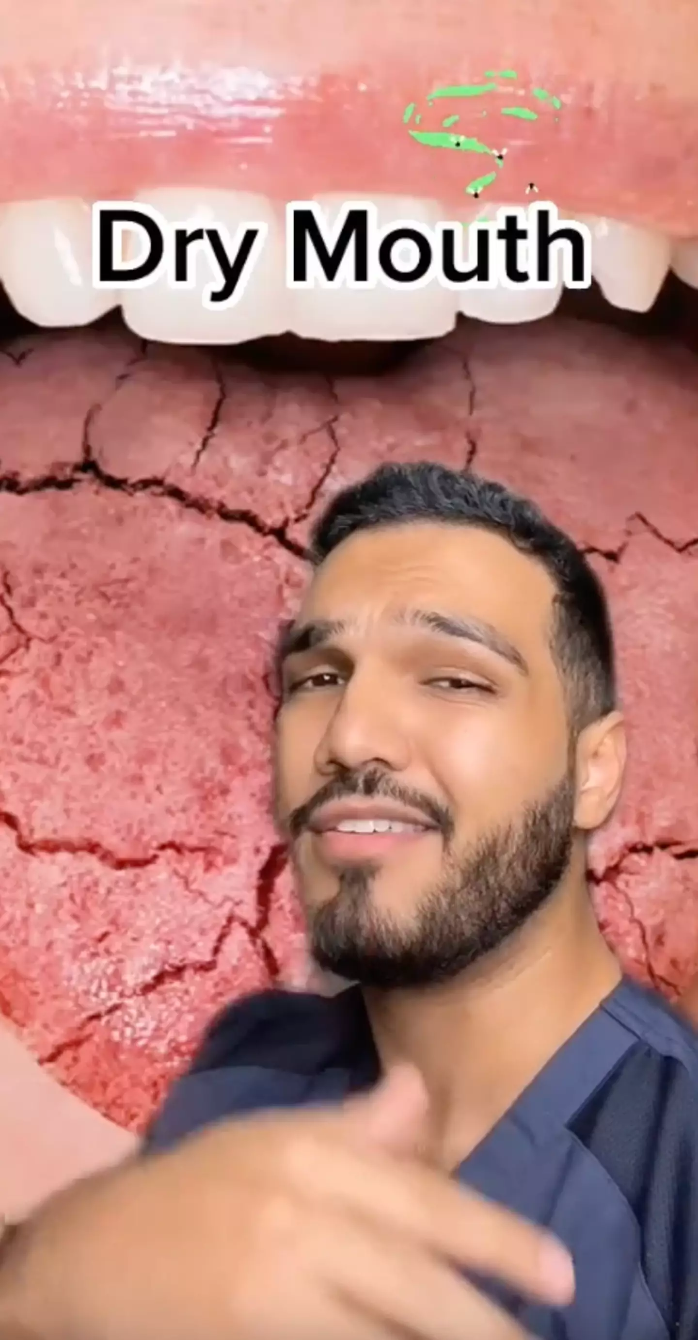 Dr Zahiri has pointed out the most common side affects vaping has on a person's mouth.