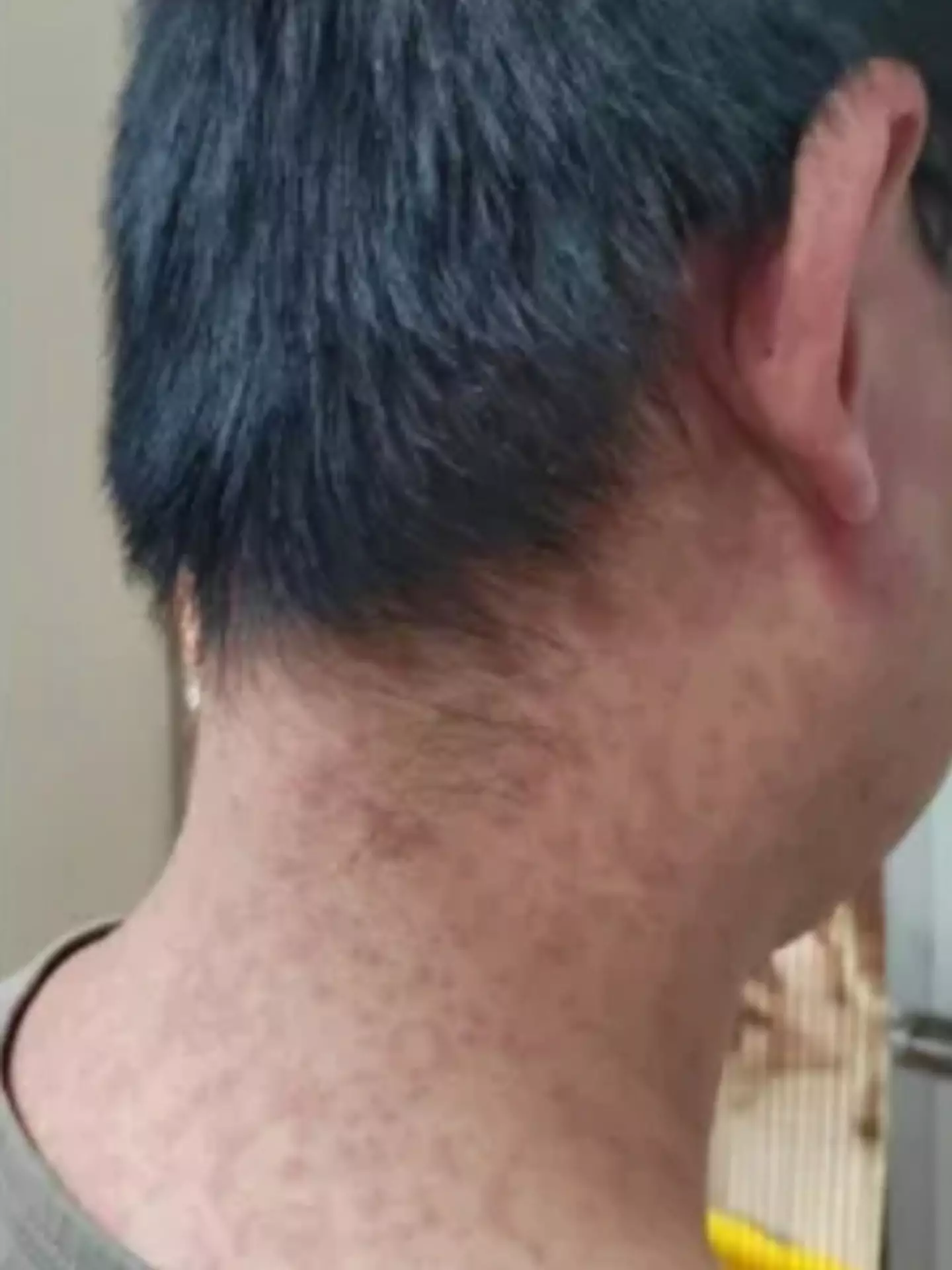 The virus usually ends within a few days or weeks. (WeChat)