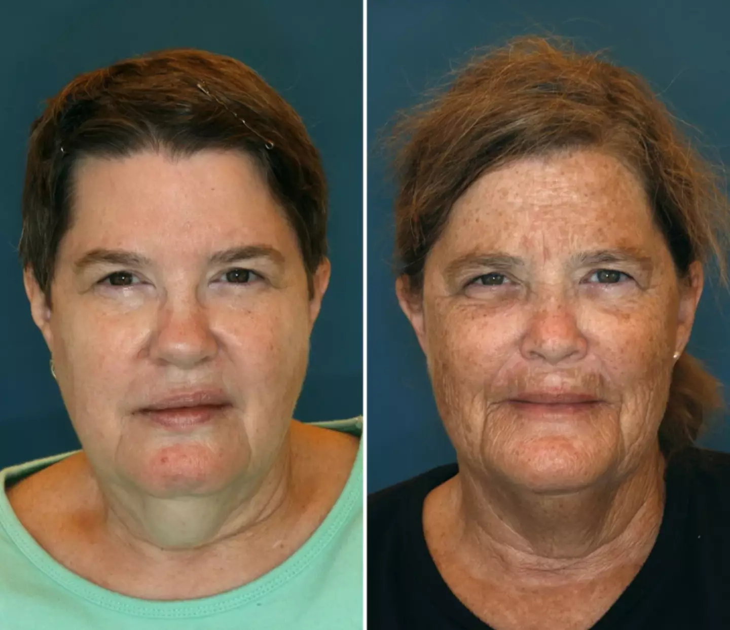 Jeanne and Susan, aged 61 (NBC)