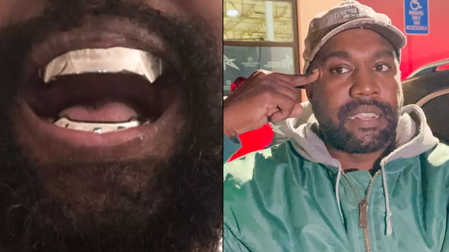 Dentist exposes ‘real cost’ of Kanye West’s 'permanent' titanium teeth reportedly worth £669,109