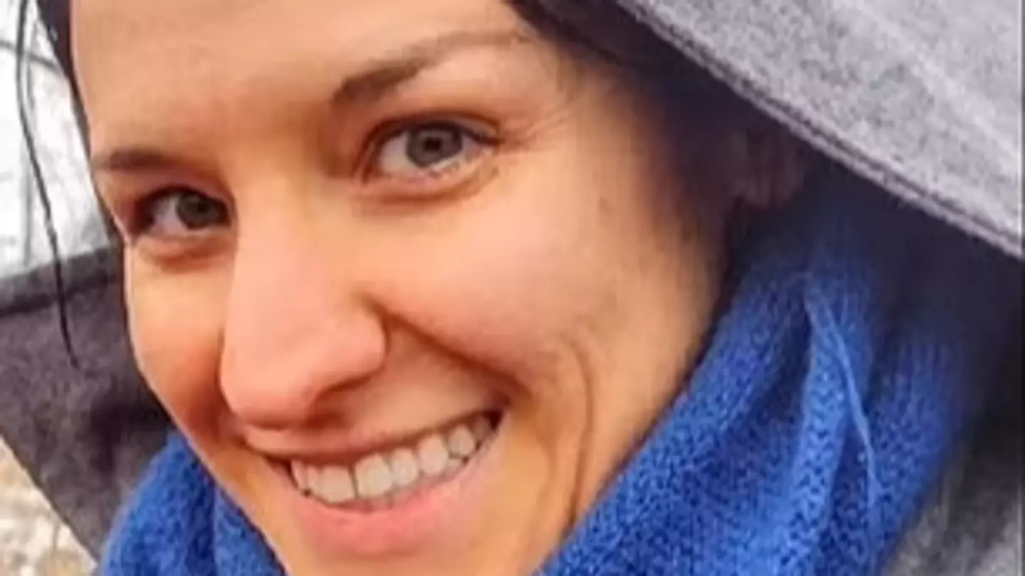 Insane side by side photos of woman show alarming effect of eating too many carrots
